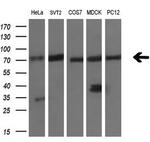 LTA4H Antibody in Western Blot (WB)