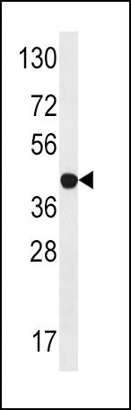 LYK5 Antibody in Western Blot (WB)