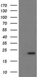 LZIC Antibody in Western Blot (WB)