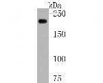 Alpha-2-macroglobulin Antibody in Western Blot (WB)