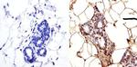 LAP1 Antibody in Immunohistochemistry (IHC)