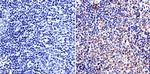 LAP1 Antibody in Immunohistochemistry (IHC)