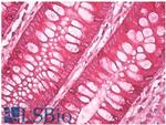 AGR2/AGR3 Antibody in Immunohistochemistry (Paraffin) (IHC (P))