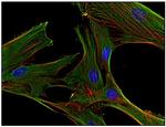 Clathrin Heavy Chain Antibody in Immunocytochemistry (ICC/IF)