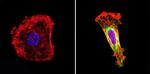 Nestin Antibody in Immunocytochemistry (ICC/IF)