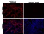 beta-3 Tubulin Antibody in Immunohistochemistry (Paraffin) (IHC (P))