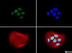 BRCA1 Antibody in Immunocytochemistry (ICC/IF)