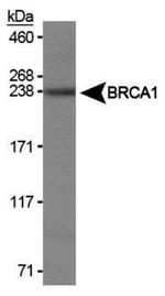 BRCA1 Antibody in Western Blot (WB)