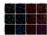 p300 Antibody in Immunocytochemistry (ICC/IF)