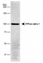 ATP1A1 Antibody in Western Blot (WB)