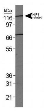 HIP1R Antibody in Western Blot (WB)