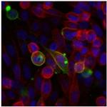 IL13RA1 Antibody in Immunocytochemistry (ICC/IF)