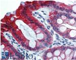 Cytokeratin 18 Antibody in Immunohistochemistry (Paraffin) (IHC (P))