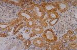 Cytokeratin 18 Antibody in Immunohistochemistry (Paraffin) (IHC (P))