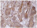 CEA Antibody in Immunohistochemistry (Paraffin) (IHC (P))