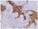 CEA Antibody in Immunohistochemistry (Paraffin) (IHC (P))