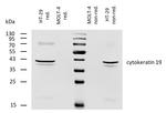 Cytokeratin 19 Antibody in Western Blot (WB)