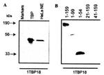 TBP Antibody in Western Blot (WB)