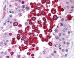 ATM Antibody in Immunohistochemistry (Paraffin) (IHC (P))