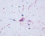 FOXO1 Antibody in Immunohistochemistry (IHC)