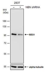 NBS1 Antibody