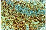 CD45RO Antibody in Immunohistochemistry (Paraffin) (IHC (P))