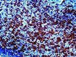 CD45RO Antibody in Immunohistochemistry (IHC)