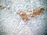 CD21 Antibody in Immunohistochemistry (Frozen) (IHC (F))