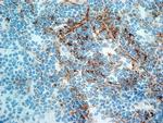 CD21 Antibody in Immunohistochemistry (Frozen) (IHC (F))