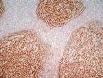 CD21 Antibody in Immunohistochemistry (Frozen) (IHC (F))