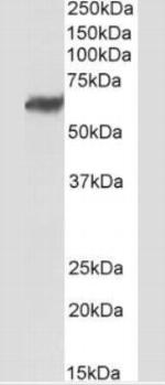 TEM7 Antibody in Western Blot (WB)