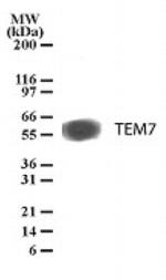 TEM7 Antibody in Western Blot (WB)