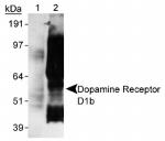 DRD5 Antibody in Western Blot (WB)