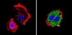 RARA Antibody in Immunocytochemistry (ICC/IF)