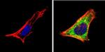 RARA Antibody in Immunocytochemistry (ICC/IF)