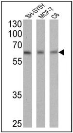 RARA Antibody in Western Blot (WB)