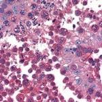 TCP-1 beta Antibody in Immunohistochemistry (IHC)