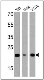 DIABLO Antibody in Western Blot (WB)