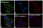 Cytokeratin 7 Antibody in Immunocytochemistry (ICC/IF)