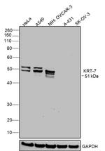 Cytokeratin 7 Antibody in Western Blot (WB)