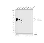 Cytokeratin 8 Antibody in Western Blot (WB)