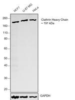Clathrin Heavy Chain Monoclonal Antibody (X22) (MA1-065)