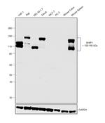 SHIP1 Antibody in Western Blot (WB)