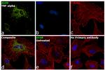 SOD2 Antibody in Immunocytochemistry (ICC/IF)