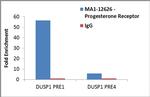 Progesterone Receptor Antibody