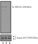 BRCA1 Antibody in Western Blot (WB)