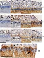 ATP1A1 Antibody in Immunohistochemistry (IHC)