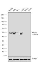 Cytokeratin 18 Antibody