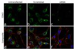 CD63 Antibody in Immunocytochemistry (ICC/IF)