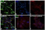 NEFM Antibody in Immunocytochemistry (ICC/IF)